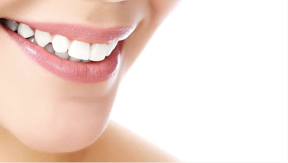 Sbiancamento dentale